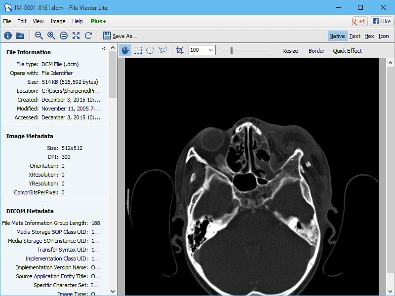 download the last version for ios Sante DICOM Viewer Pro 12.2.5